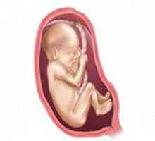 2. Trimesečje nosečnosti