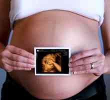 3D ultrazvok v nosečnosti