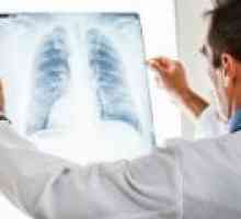 Pljučni absces: Vzroki, simptomi, zdravljenje
