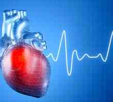 Srčna aritmija: simptomi, zdravljenje