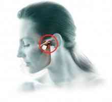 Artritis maksilofacialne skupni simptomi in zdravljenje