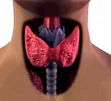 Avtoimunske tiroiditis ščitnice