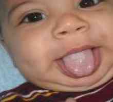 Bel jezik premaz pri dojenčkih - vzroki, simptomi, zdravljenje
