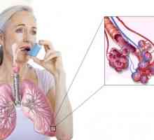 Astma: Simptomi in zdravljenje