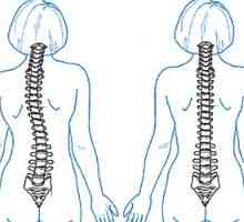 Kaj bo kiropraktik za bolečine v hrbtu?
