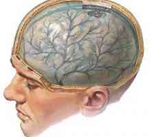 Travmatska poškodba možganov