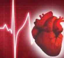 Kaj je motnje srčnega ritma?