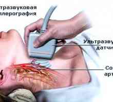 Doppler ultrazvok (ultrazvok) raziskovalna plovila možganov in vratu