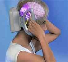 FDA odobrila uporabo prenosno napravo za migreno