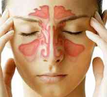 Sinusitis: simptomi, zdravljenje doma