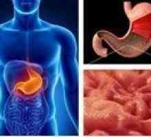 Gastritis z nizko kislost: Simptomi in zdravljenje