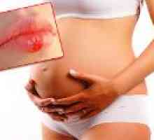Herpes med nosečnostjo - ali je to nevarno?