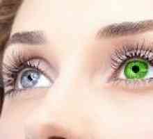 Heterokromijo oči: Vzroki, simptomi, zdravljenje