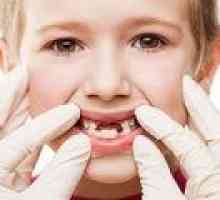 Vnetje dlesni je otrok: vzroki, simptomi, zdravljenje