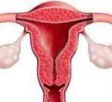 Hiperplazija endometrija po kiretaža