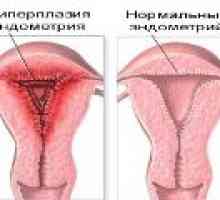 Hiperplazija endometrija zdravljenje menopavza