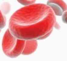 Hipokromna anemija: Vrste in zdravljenje