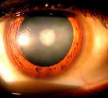 Očesni tlak: simptomi in zdravljenje