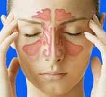 Gnojni sinusitis, vzroki, simptomi, zdravljenje
