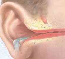 Gnojno vnetje srednjega ušesa - srednja, akutna, kronična, gnojno vnetje srednjega ušesa pri…