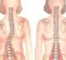 Hernija hrbtenice SHmorlja: simptomi, zdravljenje