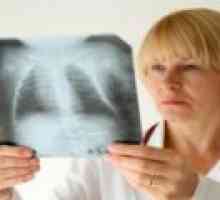 Kronično vnetje pljuč: Simptomi, zdravljenje