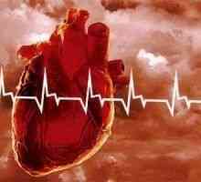 Srčni napad, vzroki za srčni infarkt