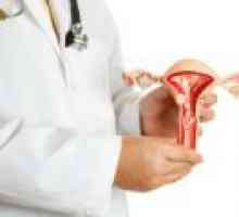 Vrinjeni fibroidi - vzroki, simptomi, zdravljenje