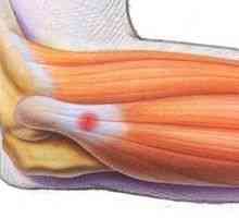 Kateri je razlog, zakaj bolečine v koleno?