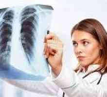 Hidatidoza bolezen pljuč, kaj je to?