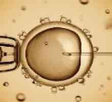 In vitro oploditev (IVF) - kako se pripraviti?