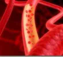 Kako čistiti in zdraviti krvne žile?