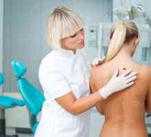 Kako prepoznati in zdraviti melanom hrbtenico