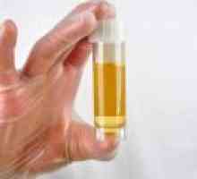 Kako opraviti test urina med nosečnostjo?