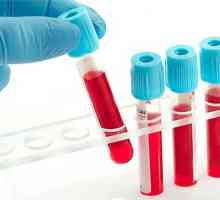 Kakšna je stopnja hemoglobina v krvi žensk?