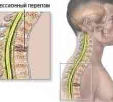 Zlom stiskanje hrbtenice, simptomi, zdravljenje