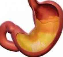 Zdravljenje gastritisa z visoko kislost
