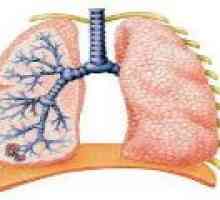 Zdravljenje obstruktivnega bronhitisa