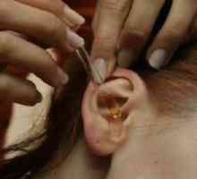 Zdravljenje vnetja srednjega ušesa - srednja, gnojen, na prostem, zdravljenje vnetja srednjega…