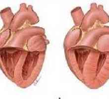 Pljučna srčne bolezni: vzroki, simptomi, zdravljenje