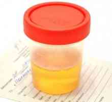 Levkociti v urinu vzrokov povečala