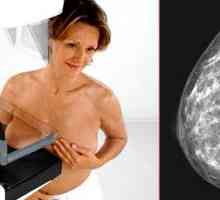 Mamografija prsi