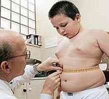 Metformin je neučinkovita pri zdravljenju debelosti pri otrocih