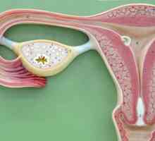 Fibroidi velikost za operacije