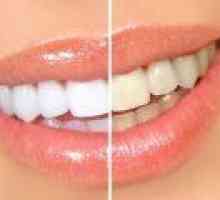 Ali je možno beljenje zob doma? Najbolj priljubljena metode