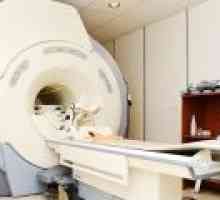 MRI možganov