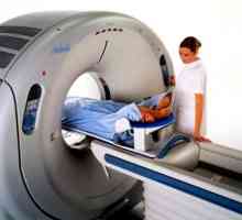 MRI pljuč: Kdaj se prijaviti?