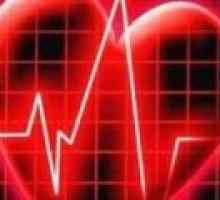 Srčnega ritma, vzroki, zdravljenje