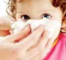 Izcedek iz nosu, brez vročine pri otroku, kot za zdravljenje?