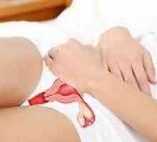 Oviranje nožnice in materničnega vratu: glavni zdravljenje